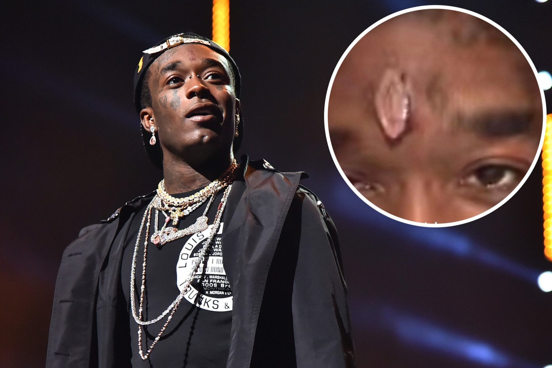 Rapper Lil Uzi Vert Gets A Diamond Implant On His Forehead Like Marvel