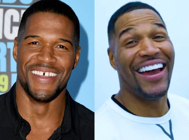 Michael Strahan Gets Rid Of His Iconic Tooth Gap Check Out The Video Pressboltnews 